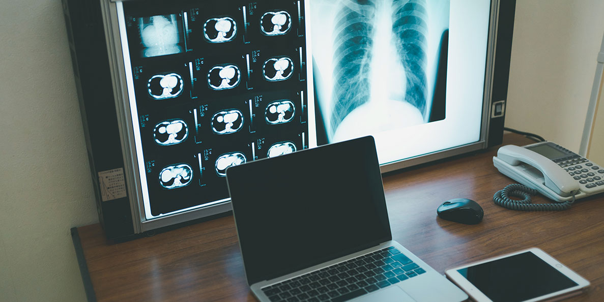 胃部・胸部X線のデジタル撮影